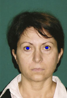 Bleafroplastica prima